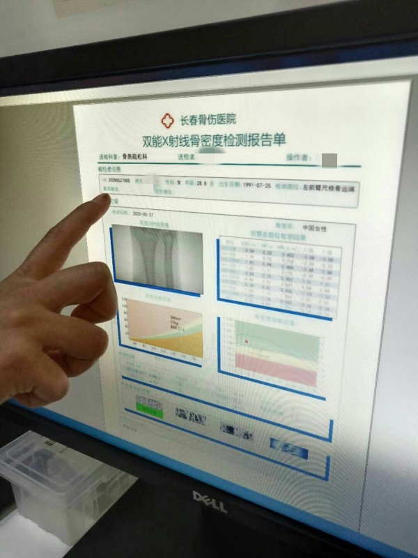 品源雙能X射線骨密度儀落戶吉林省長春骨傷醫(yī)院，助力骨松診療