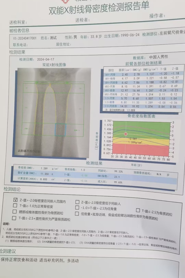 雙能X射線骨密度儀：準(zhǔn)確測量骨密度，助力骨質(zhì)疏松防治，守護(hù)骨骼健康